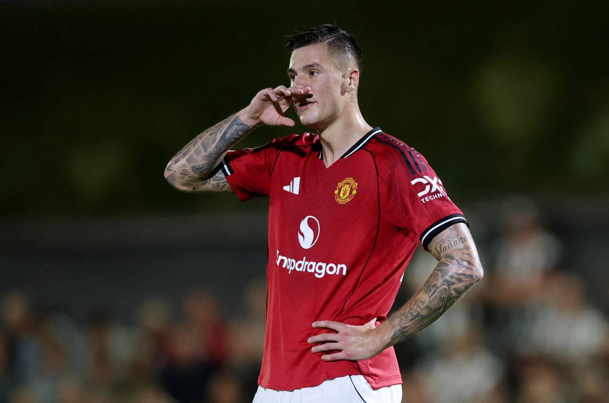 天空：曼联前锋舍什科伤病不严重，预计最多缺席一个月